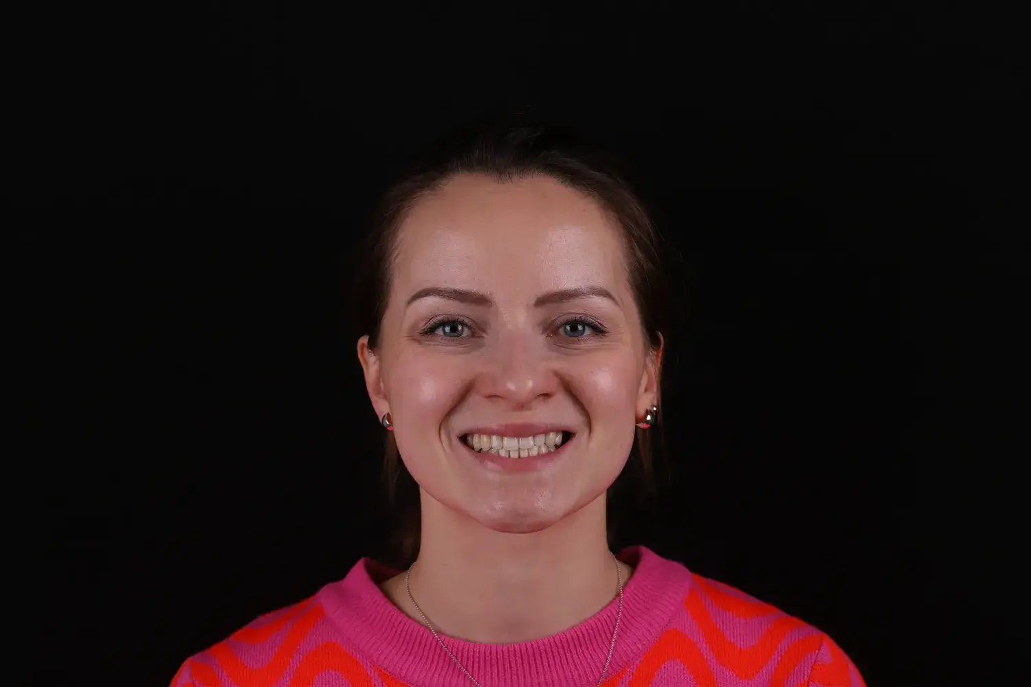 Пациент до и после лечения - случай 1