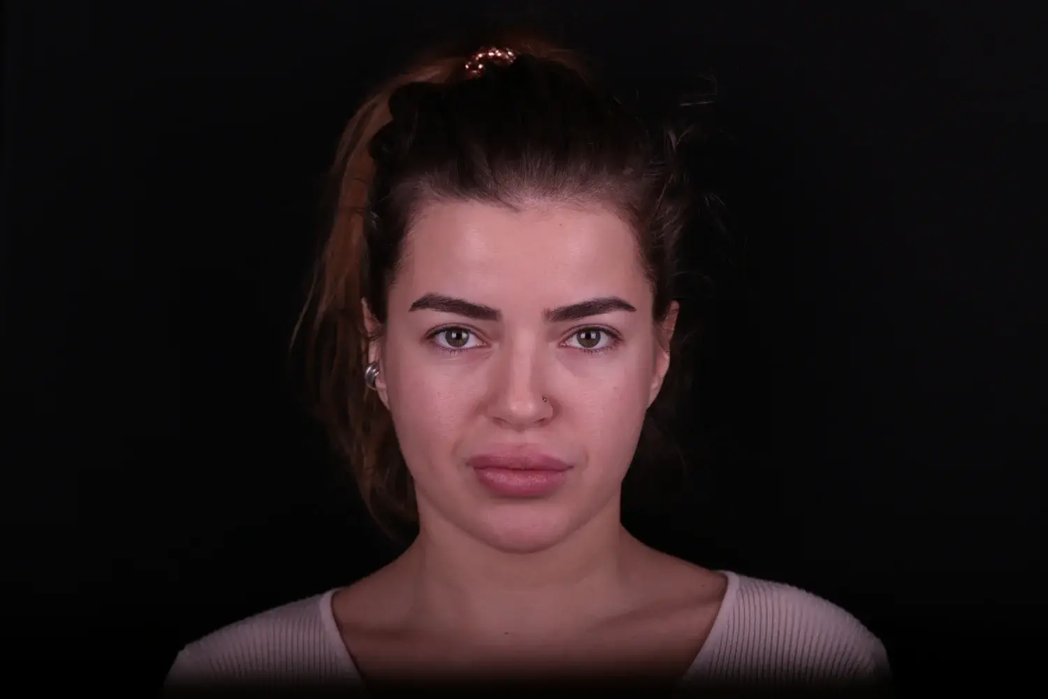 Пациент до и после лечения - случай 13