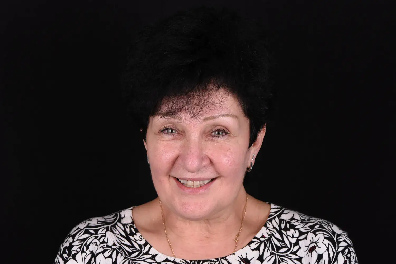 Пациент до и после лечения - случай 4