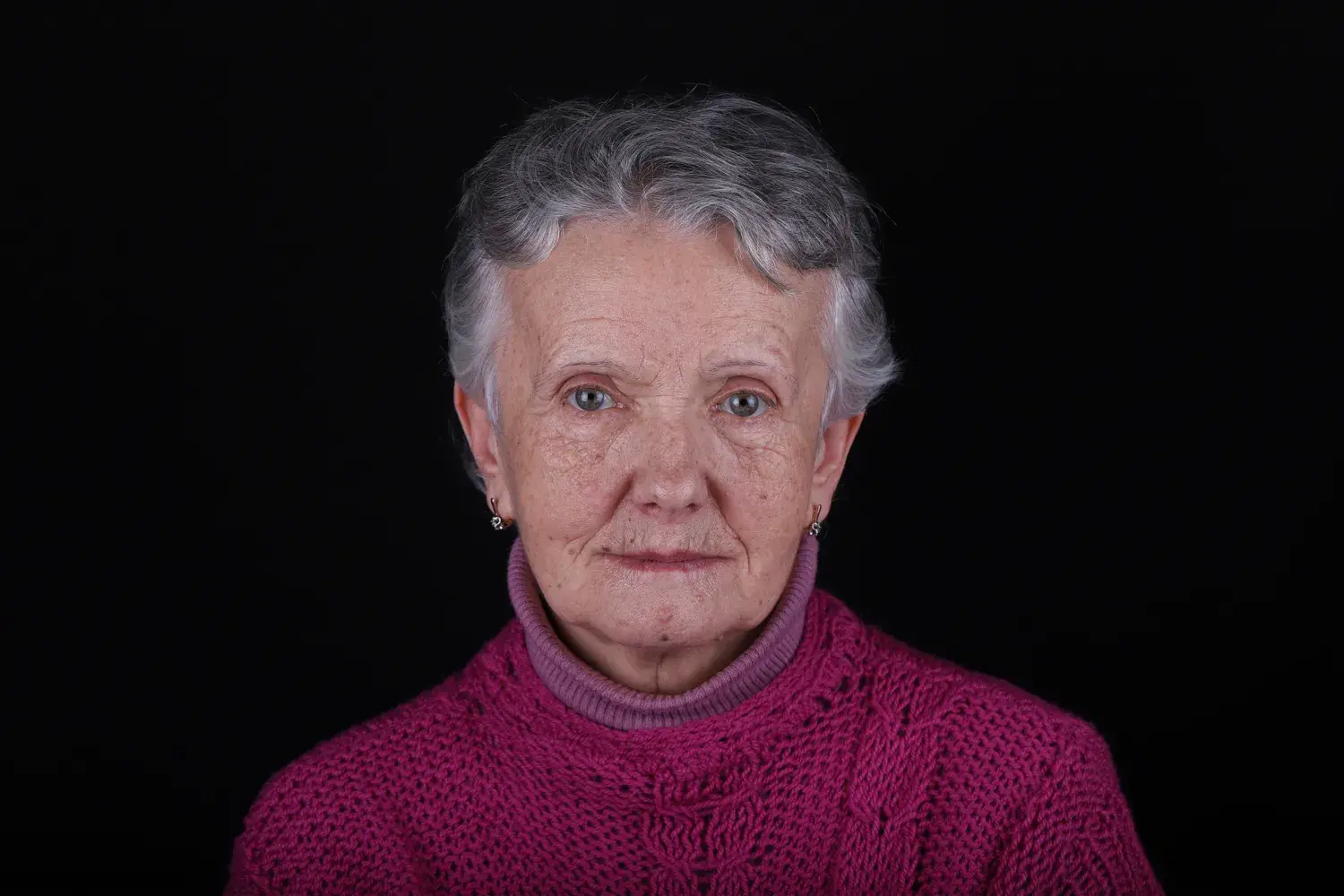 Пациент до и после лечения - случай 6