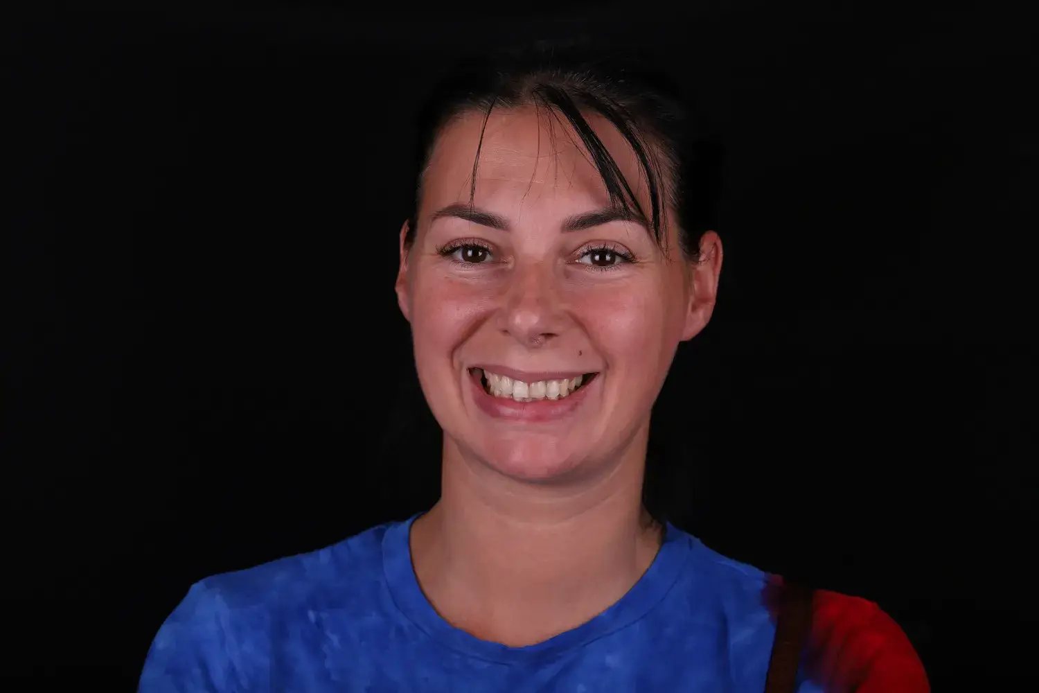 Пациент до и после лечения - случай 7