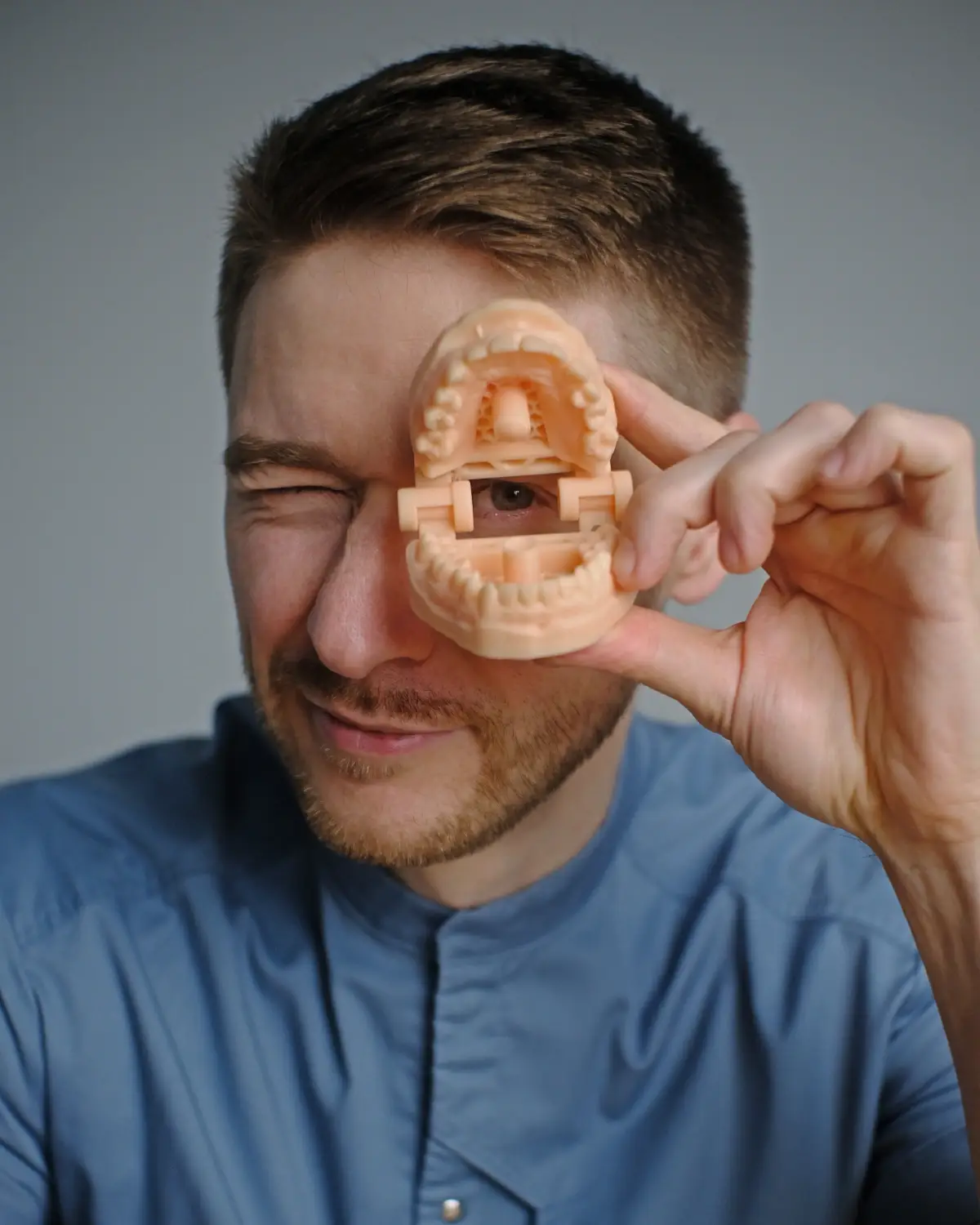 All on 4/6 — протезирование на имплантах